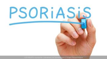 Psoriasis